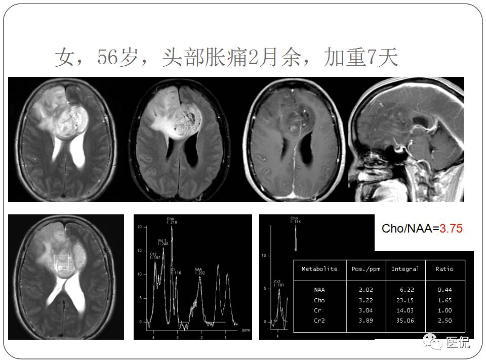 神经系统解剖ppt课件,神经内科课件ppt
