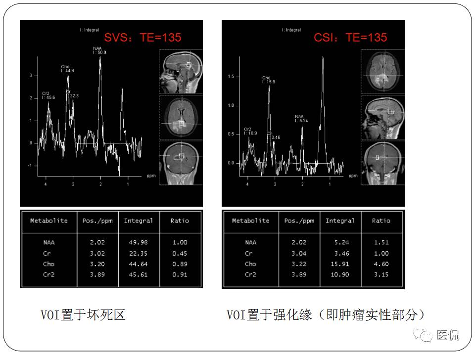 神经系统解剖ppt课件,神经内科课件ppt