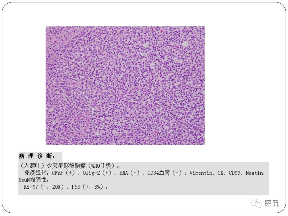 神经系统解剖ppt课件,神经内科课件ppt