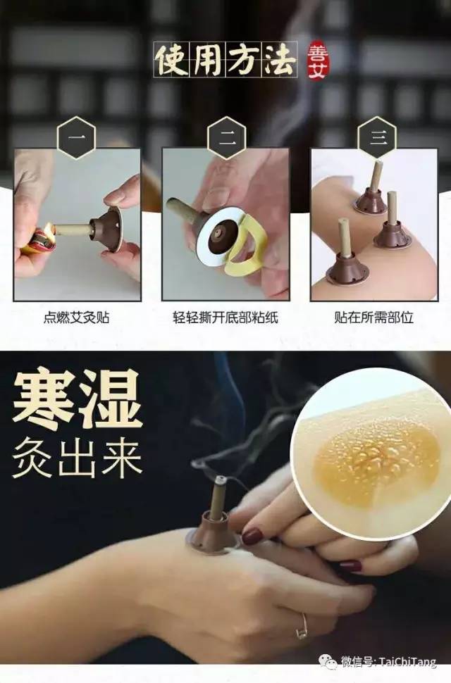 女性艾灸腹部穴位的功效与作用,艾灸神阙穴位的功效与作用