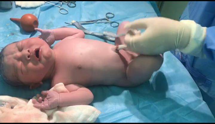 全球首例MALBAC-PGD™阻断无先证者先天多发性关节挛缩症健康婴儿诞生于北京*013院医**｜附卢彦平主任、彭红梅主任访谈