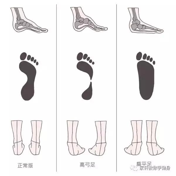 xo型腿怎么矫正和瘦腿,xo型腿怎么矫正视频