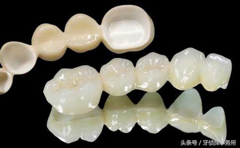 纳米补牙和树脂补牙区别,自己用补牙材料补牙