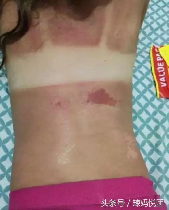 宝宝皮肤娇嫩涂防晒霜就能防晒吗,宝宝防晒1岁女宝