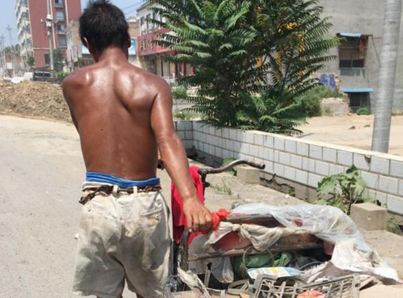 高温流汗多引起发热食欲不振,夏天流汗多缺钾怎么补充