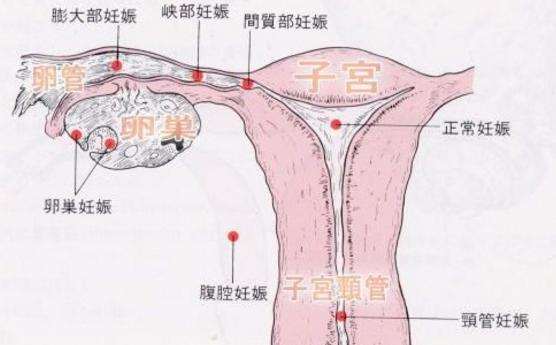 孕期小出血，大流产！妊娠早期的这点小知识不可不知
