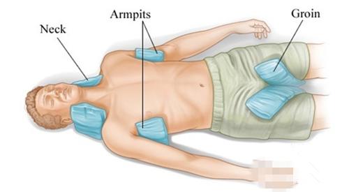中暑为什么能死亡,中暑怎样引起的