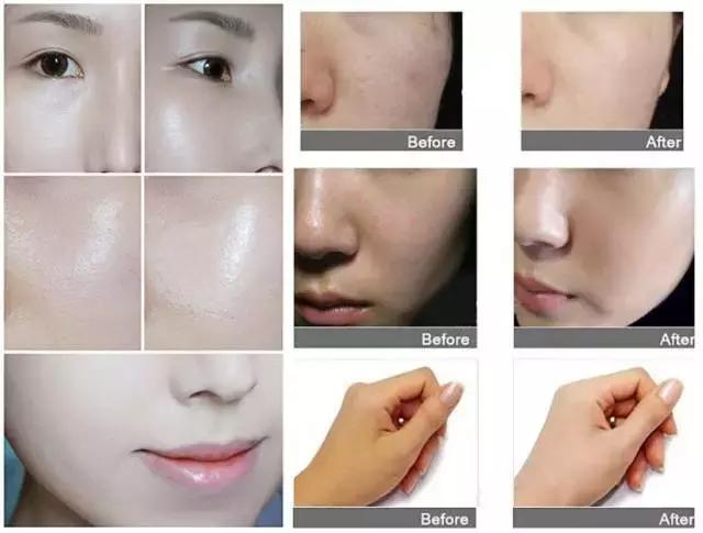 补妆气垫神器方便携带小样,补妆气垫推荐干皮夏季