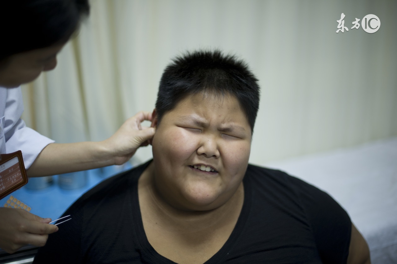 激素依赖性皮炎可以打针来治疗吗,激素脸口服皮肤抗炎药还会反复吗