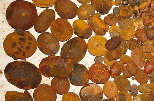 动物肾结石怎么造成的,人得了结石病哪些东西吃不得