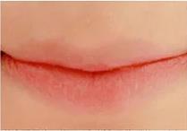 澶槼鐨勫悗瑁斿畫鎱т箶鐪肩嚎鐢绘硶,瀹嬫収涔斿お闃崇殑鍚庤鐪煎