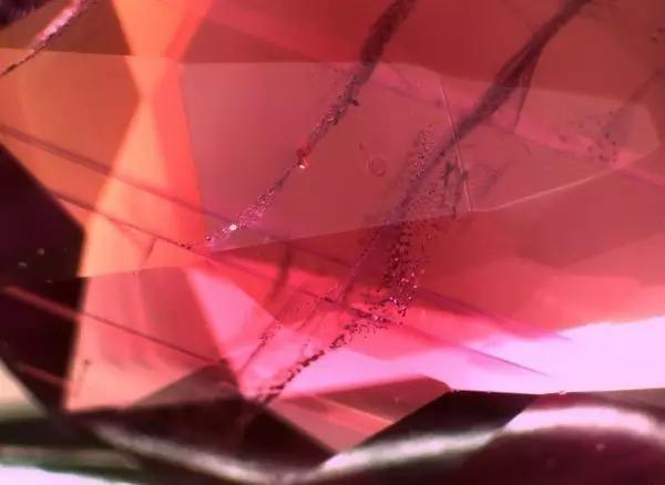 瞪大眼睛可以看出啥,瞪大眼才能看清是近视吗