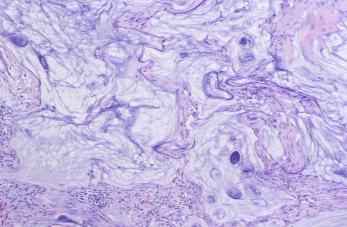 腹胀是怎么回事小心是这里生病了,腹胀是什么原因引起的胃不舒服