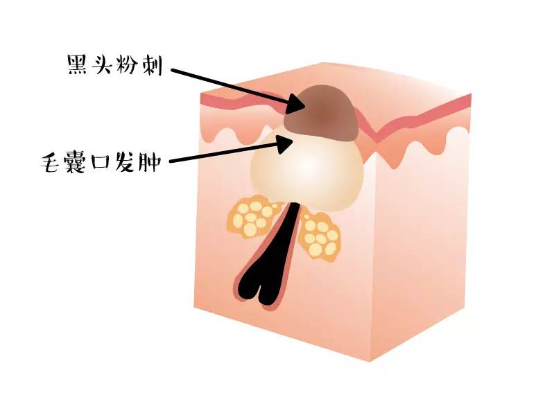 平价精华和面膜哪个好用,平价好用的清洁面膜求推荐