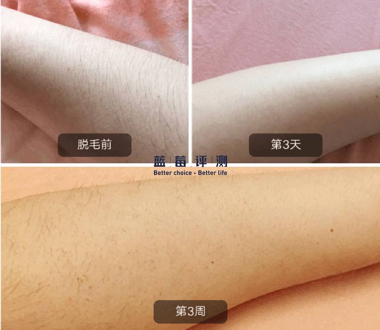 十大公认最好的美容仪,目前最好的美容仪是哪种