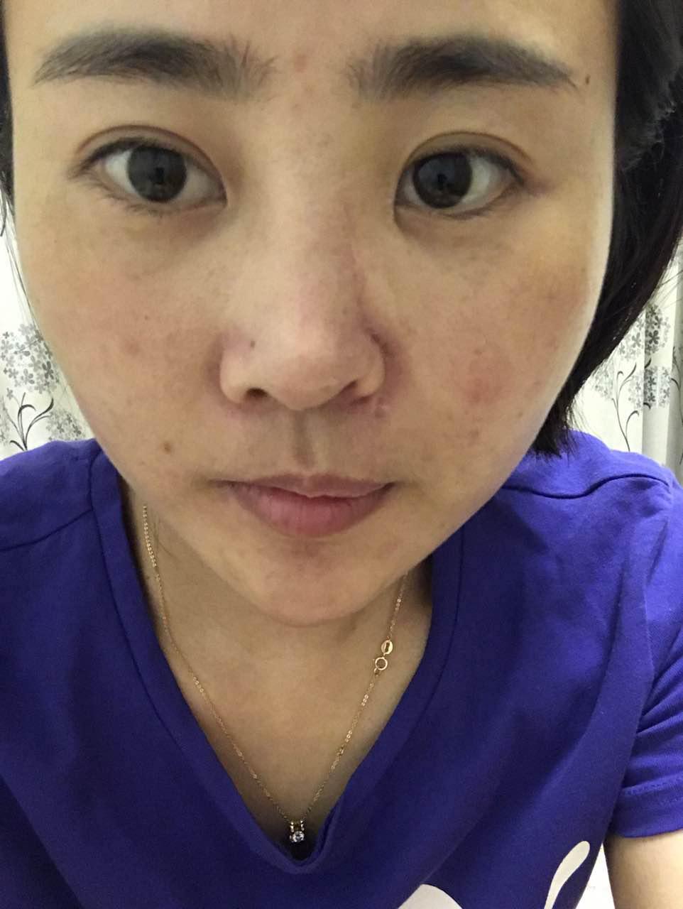 丽江被打毁容女游客视频,女游客丽江被打毁容案