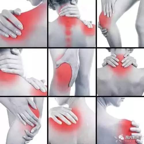 「推荐」关节炎患者的福音，院内制剂中的佼佼者！广东省中医院第四波最受欢迎的院内明星宝贝来了！
