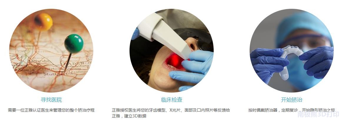 隐形牙套3d打印机,隐形牙套光固化3d打印