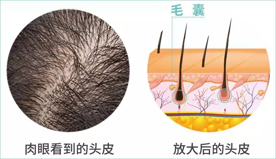 白头发会不会拔一根长十根,俗话说白头发拔一根长十根为什么