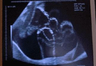 胎儿早晨不爱动怎么数胎动,胎儿不正常的胎动是怎样