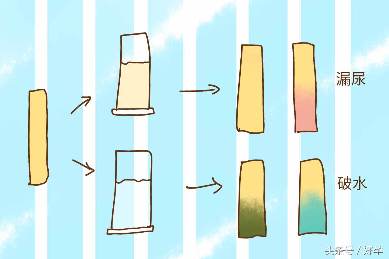 破水和漏尿傻傻分不清,30周孕妇怎么分辨破水和漏尿
