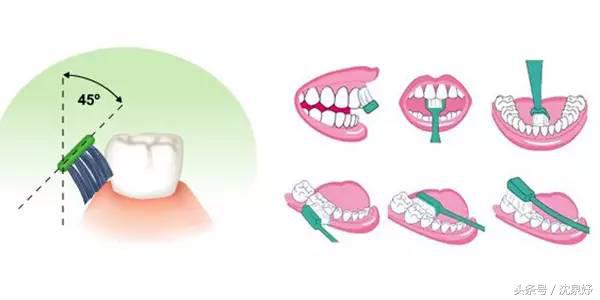每天刷牙牙齿还黄？学会这些是美白牙齿的关键