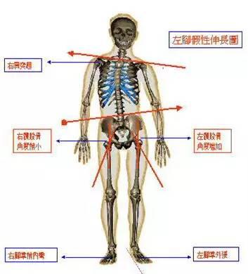 徒手整形许强分享：原来骨盆不正对女性影响这么大