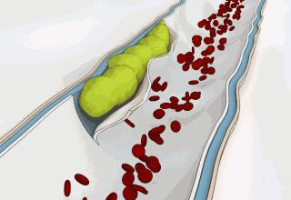 心梗直播间,心梗发病全过程视频