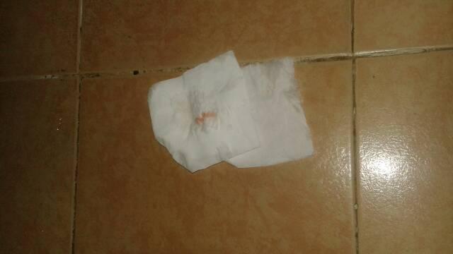 怀孕初期遇到出血的情况怎么办？