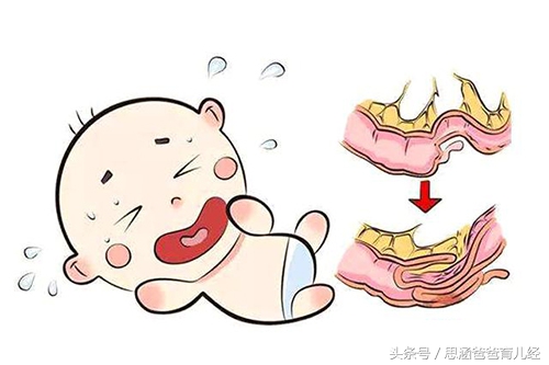 三岁小孩突发急性肠套叠,幼儿肠套叠应急办法