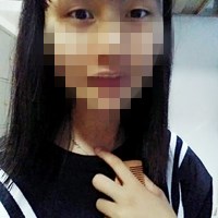 双眼皮松弛全切恢复过程,全切双眼皮几天可以洗脸