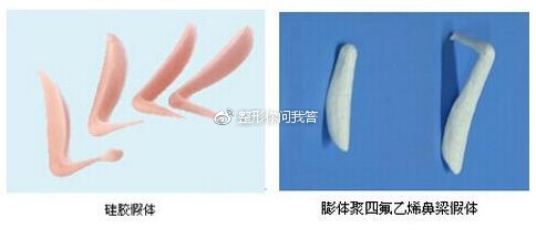 做假体下巴用硅胶好还是膨体好,下巴假体是做膨体好还是硅胶好