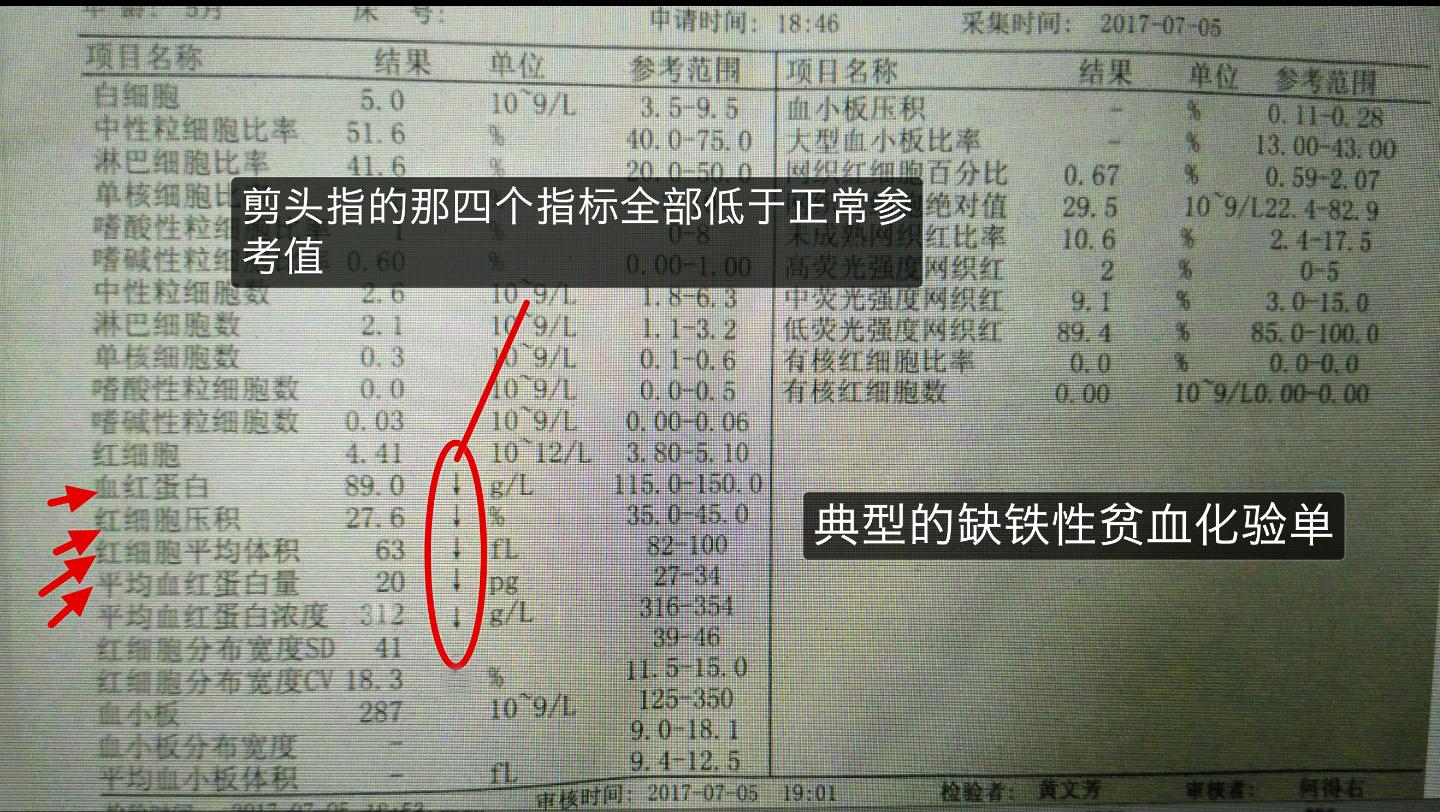 血常规报告单数据可以看出贫血,地中海贫血的血常规报告单怎么看