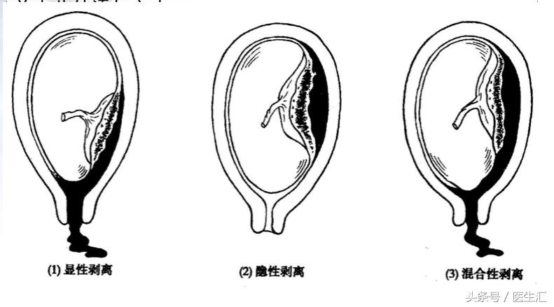 生孩子很危险的病,生孩子有多危险