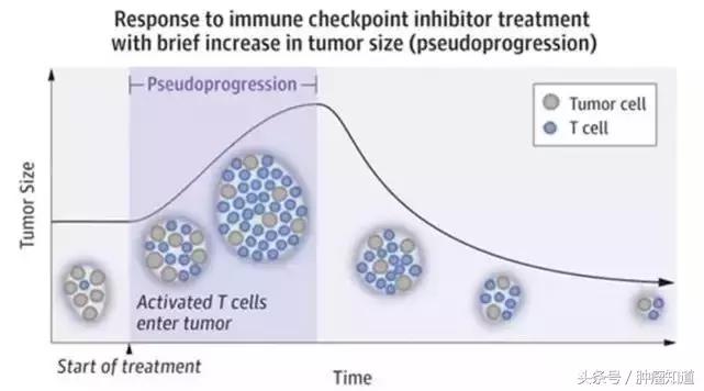 pd-1是什么制剂 (pd-1与pd-l的区别)