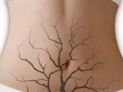 女性哪个器官容易老,女人最先老的是哪里