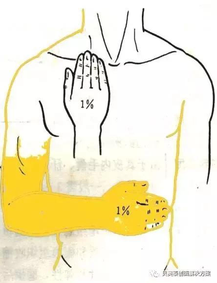 烧伤的诊断标准图表,烧伤病人典型症状