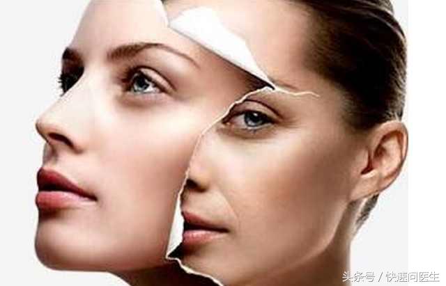 色素沉着淡斑内调方法,色素色斑怎么祛除最有效