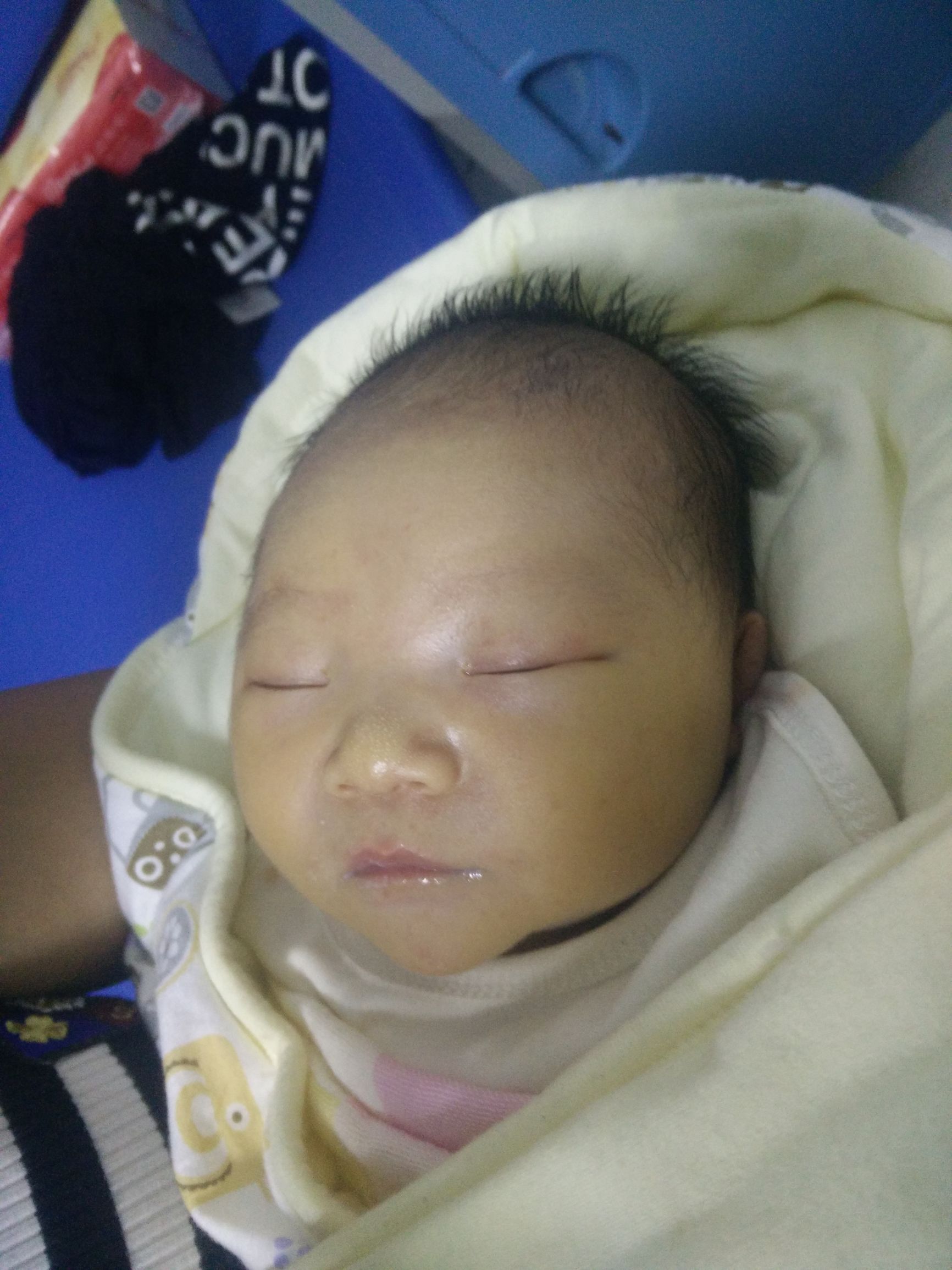 宝宝湿疹妈妈很着急,宝宝湿疹的正确防治方法