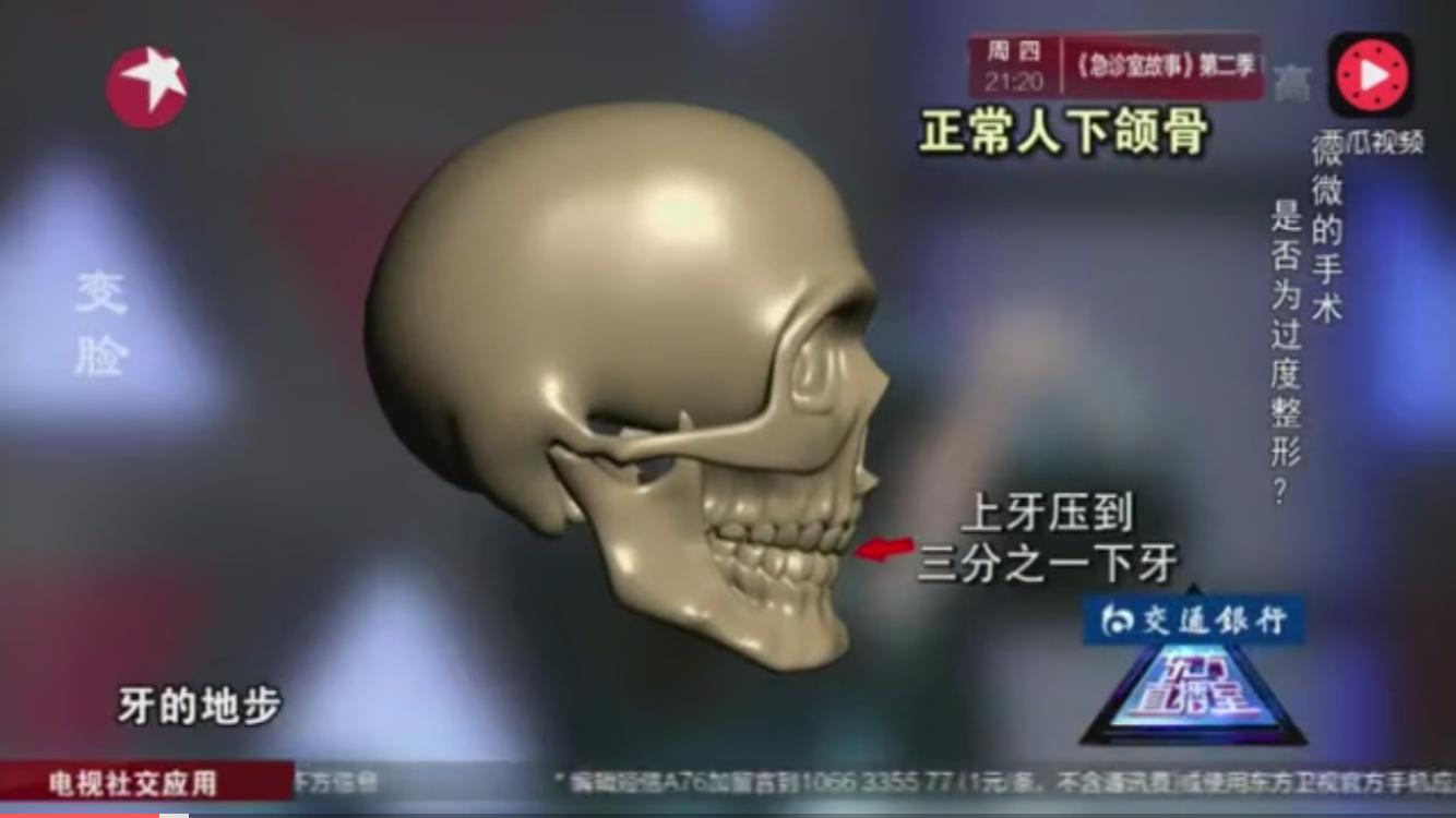 盘点一下韩国整形失败,韩国整形最难做的手术