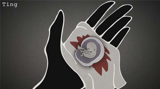 堕胎手术有多可怕,做了堕胎手术