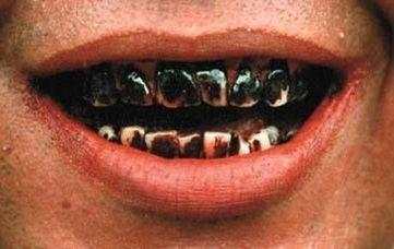 小伙吃槟榔上瘾嘴都歪,小伙吃槟榔嘴巴受限