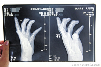 护士假扮医生违法吗,护士冒充大夫