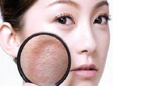 城野医生收敛水为什么凉凉的,城野医生收敛水有消炎祛痘作用吗