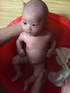 疝气有什么症状手术风险大吗,如何治疗与预防疝气