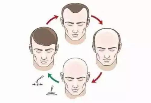 日常吃什么头发长得快又黑又亮密,乌黑浓密头发的食物