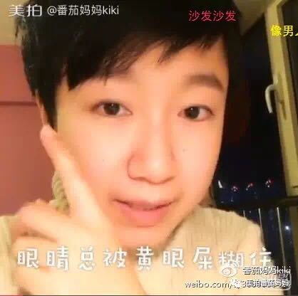 宝宝眼睛黄色眼屎导致眼睛发红,宝宝眼睛眼屎多黄稠怎么解决