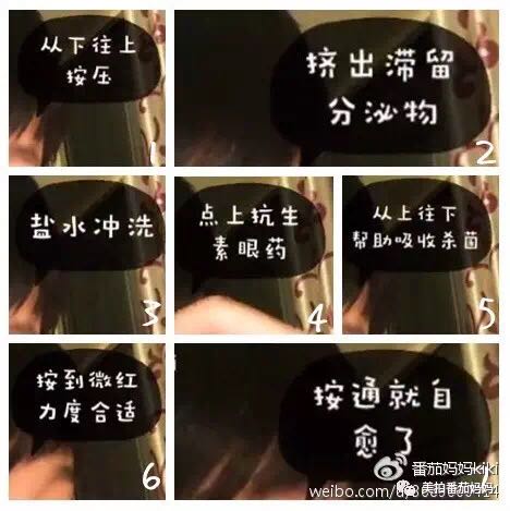 宝宝眼睛黄色眼屎导致眼睛发红,宝宝眼睛眼屎多黄稠怎么解决