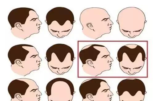 日常吃什么头发长得快又黑又亮密,乌黑浓密头发的食物