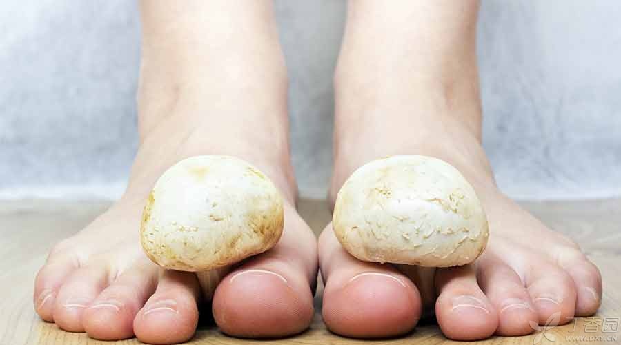 关于脚气你了解多少,关于脚气的真相